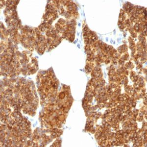 Formalin-fixed, paraffin-embedded human Parathyroid Gland stained with PTH Rabbit Polyclonal Antibody.
