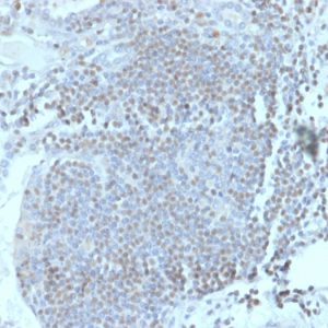 Formalin-fixed, paraffin-embedded human lymph node stained with HOMEZ Mouse Monoclonal Antibody (PCRP-HOMEZ-1A5).