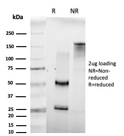 SDS-PAGE Analysis of Purified HOMEZ Mouse Monoclonal Antibody (PCRP-HOMEZ-1A5). Confirmation of Purity and Integrity of Antibody.