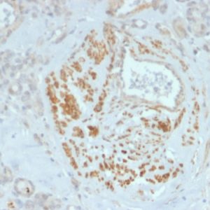 Formalin-fixed, paraffin-embedded human breast stained with HOMEZ Mouse Monoclonal Antibody (PCRP-HOMEZ-1B5).