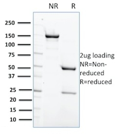 SDS-PAGE Analysis of Purified PTPN6 Mouse Monoclonal Antibody (CPTC-PTPN6-2). Confirmation of Purity and Integrity of Antibody.