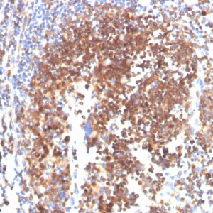Formalin-fixed, paraffin-embedded human tonsil stained with SLAMF7 / CS1 Mouse Monoclonal Antibody (SLAMF7/3649).