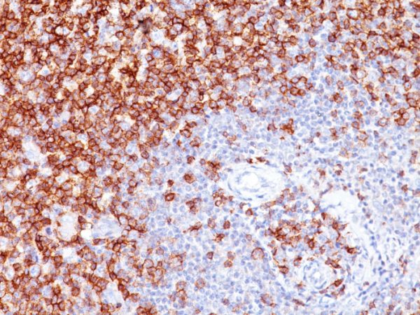 Formalin-fixed, paraffin-embedded human Tonsil stained with CD45RO Monoclonal Antibody (UCHL-1).