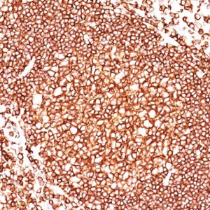 Formalin-fixed, paraffin-embedded human tonsil stained with CD45 Monoclonal Antibody (136-4B5)