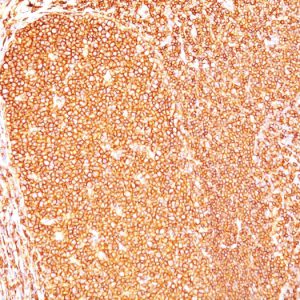 Formalin-fixed, paraffin-embedded human Tonsil stained with CD45 Mouse Monoclonal Antibody (Bra55).
