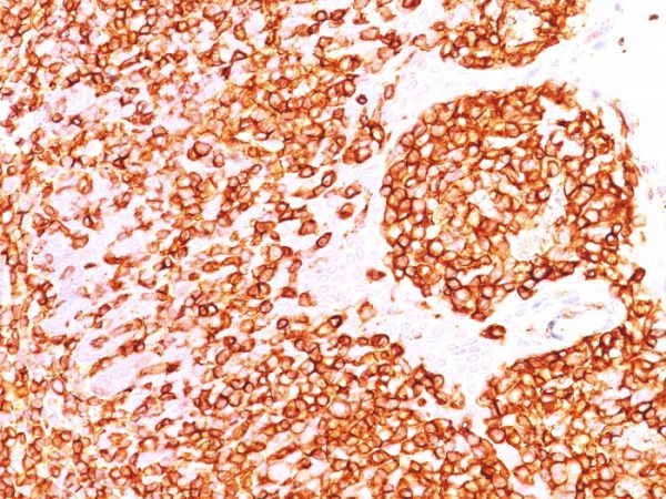 Formalin-fixed, paraffin-embedded human Tonsil stained with CD45RB Monoclonal Antibody (DF-B1).