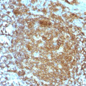 Formalin-fixed, paraffin-embedded human Tonsil stained with CD45RA Mouse Monoclonal Antibody (PTPRC/818).