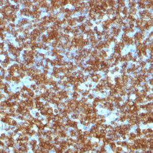 Formalin-fixed, paraffin-embedded human Tonsil stained with CD45RA Monoclonal Antibody (PTPRC/1131).
