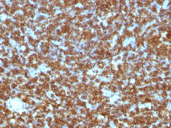 Formalin-fixed, paraffin-embedded human Tonsil stained with CD45RA Monoclonal Antibody (PTPRC/1131).
