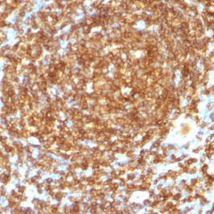 Formalin-fixed, paraffin-embedded human Tonsil stained with CD45RB Monoclonal Antibody (PTPRC/1132).