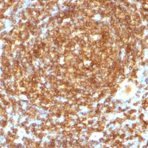 CD45RB (B-Cell Marker) Antibody