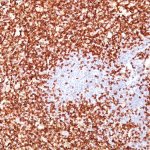 Formalin-fixed, paraffin-embedded human Tonsil stained with CD45RO Monoclonal Antibody (UCHL-1 + T200/797).