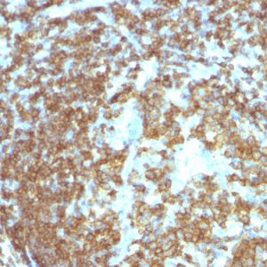 Formalin-fixed, paraffin-embedded human Tonsil stained with CD45RA Mouse Monoclonal Antibody (158-4D3).