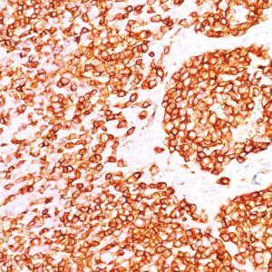 Formalin-fixed, paraffin-embedded human Tonsil stained with CD45 Monoclonal Antibody (PTPRC/1460).