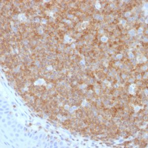 Formalin-fixed, paraffin-embedded human tonsil stained with CD45 / LCA Mouse Monoclonal Antibody (F10-89-4). HIER: Tris/EDTA, pH9.0, 45min. 2°C: HRP-polymer, 30min. DAB, 5min.