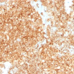 Formalin-fixed, paraffin-embedded human Tonsil stained with CD45 Mouse Monoclonal Antibody (PTPRC/1147 + PTPRC/1460).