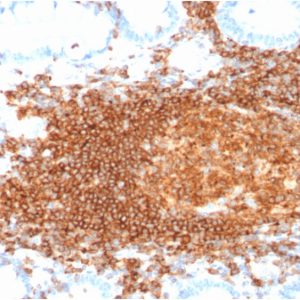 Formalin-fixed, paraffin-embedded human Lymph Node stained with CD45RB Recombinant Mouse Monoclonal Antibody (rPTPRC/1132).