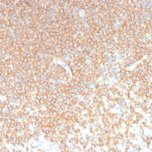 Formalin-fixed paraffin-embedded human spleen stained with CD45RA Monoclonal Antibody (rPTPRC/1131).