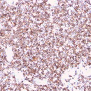 Formalin-fixed, paraffin-embedded human Tonsil stained with CD45 Recombinant Mouse Monoclonal Antibody (rPTPRC/1461).