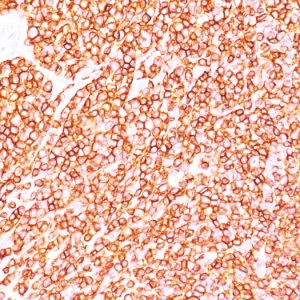 Formalin-fixed, paraffin-embedded human Tonsil stained with CD45 Monoclonal Antibody (SPM570).