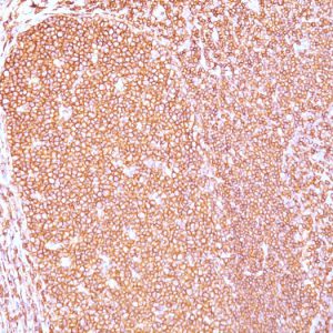 Formalin-fixed, paraffin-embedded human Tonsil stained with CD45RB Mouse Monoclonal Antibody (PD7/26).