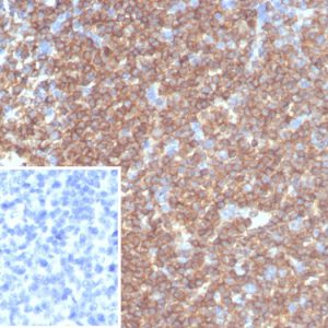 Formalin-fixed, paraffin-embedded human tonsil stained with CD45RA Recombinant Mouse Monoclonal Antibody (rPTPRC/7284). Inset: PBS instead of primary antibody; secondary only negative control.