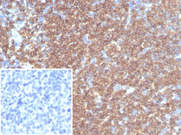 Formalin-fixed, paraffin-embedded human tonsil stained with CD45RA Recombinant Mouse Monoclonal Antibody (rPTPRC/7284). Inset: PBS instead of primary antibody; secondary only negative control.