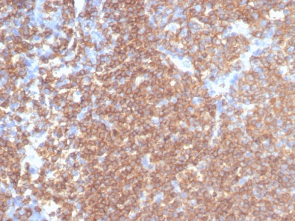 Formalin-fixed, paraffin-embedded human tonsil stained with CD45RA Recombinant Mouse Monoclonal Antibody (rPTPRC/7284). HIER: Tris/EDTA, pH9.0, 45min. 2°C: HRP-polymer, 30min. DAB, 5min.