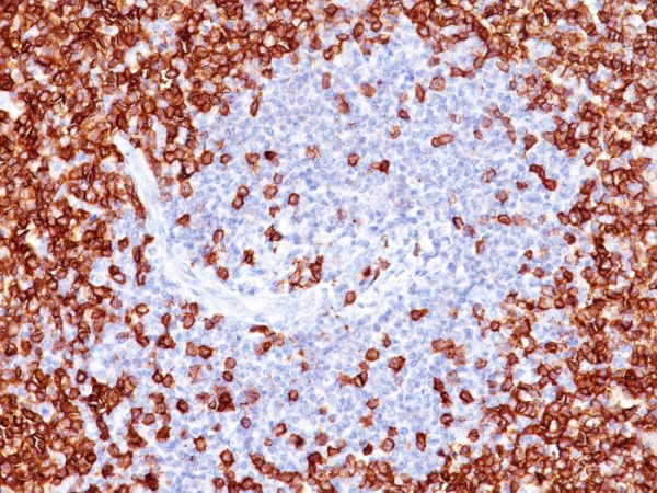 Formalin-fixed, paraffin-embedded human Tonsil stained with CD45RO Mouse Monoclonal Antibody (T200/797).