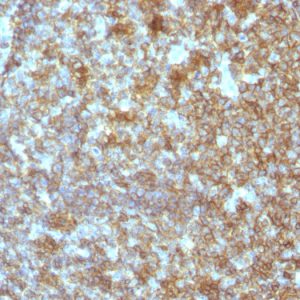 Formalin-fixed, paraffin-embedded human Tonsil stained with CD45RA Monoclonal Antibody (SPM504).