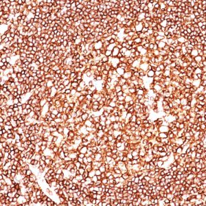 Formalin-fixed, paraffin-embedded human tonsil stained with CD45 Monoclonal Antibody (135-4C5).