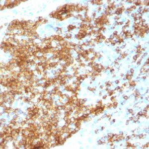 Formalin-fixed paraffin-embedded human tonsil stained with CD45RB Rabbit Recombinant Monoclonal Antibody (PTPRC/1783R).