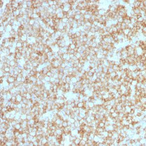 Formalin-fixed, paraffin-embedded human Tonsil stained with CD45 Recombinant Rabbit Monoclonal Antibody (PTPRC/1783R + PTPRC/1975R).