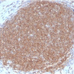 Formalin-fixed, paraffin-embedded human Lymph Node stained with CD45RB Rabbit Recombinant Monoclonal Antibody (PTPRC/2877R).