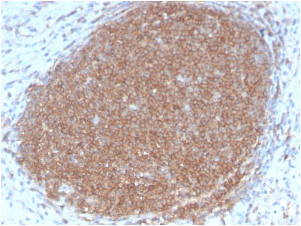 Formalin-fixed, paraffin-embedded human Lymph Node stained with CD45RB Rabbit Recombinant Monoclonal Antibody (PTPRC/2877R).