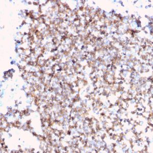 Formalin-fixed, paraffin-embedded human tonsil stained with CD45 Recombinant Rabbit Monoclonal Antibody (PTPRC/3881R).