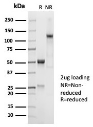SDS-PAGE Analysis Purified CD45RA Recombinant Rabbit Monoclonal Antibody (PTPRC/7018R) Confirmation of Purity and Integrity of Antibody