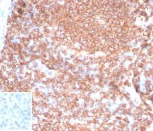 Formalin-fixed, paraffin-embedded human tonsil stained with CD45RA Recombinant Rabbit Monoclonal Antibody (PTPRC/7019R). Inset: PBS instead of primary antibody; secondary only negative control.