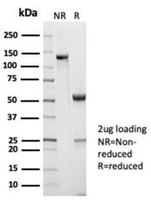 SDS-PAGE Analysis of Purified CD45RA Recombinant Rabbit Monoclonal Antibody (PTPRC/7019R). Confirmation of Purity and Integrity of Antibody.