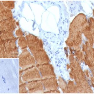 Formalin-fixed, paraffin-embedded human skeletal muscle stained with Skeletal Muscle Actin Mouse Monoclonal (ACTA1/360). Inset: PBS instead of primary antibody; secondary only negative control.