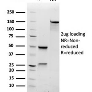 SDS-PAGE Analysis Purified RAC1Mouse Monoclonal Antibody (CPTC-RAC1-1). Confirmation of Integrity and Purity of Antibody.