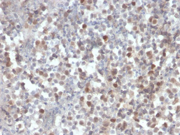 Formalin-fixed, paraffin-embedded human kidney stained with RAD51 Mouse Monoclonal Antibody (RAD51/2856).