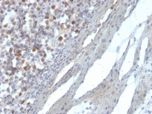 Formalin-fixed, paraffin-embedded human kidney stained with RAD51 Mouse Monoclonal Antibody (RAD51/2856).