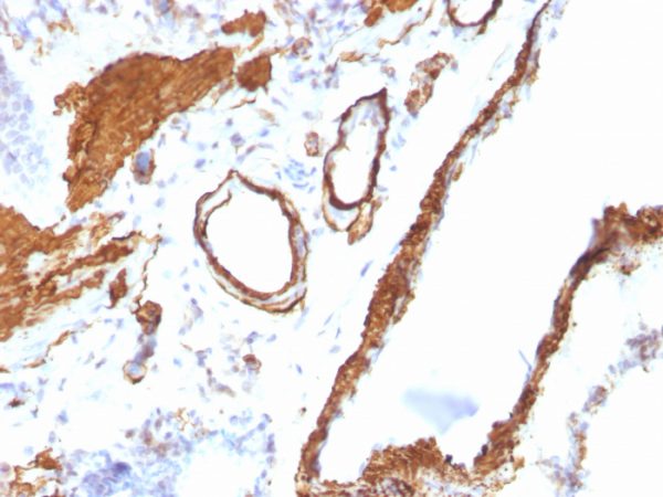 Formalin-fixed, paraffin-embedded Rat Lung stained with Smooth Muscle Actin MAb (ACTA2/791).