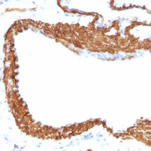 Formalin-fixed, paraffin-embedded Rat Lung stained with Smooth Muscle Actin Monoclonal Antibody (1A4 + ACTA2/791).