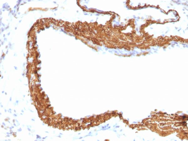 Formalin-fixed, paraffin-embedded Rat Lung stained with Smooth Muscle Actin Monoclonal Antibody (1A4 + ACTA2/791).