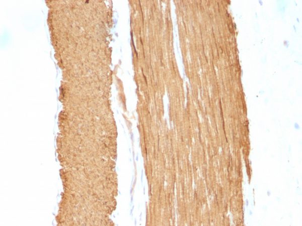 Formalin-fixed, paraffin-embedded Rat Stomach stained with Smooth Muscle Actin Monoclonal Antibody (1A4 + ACTA2/791).