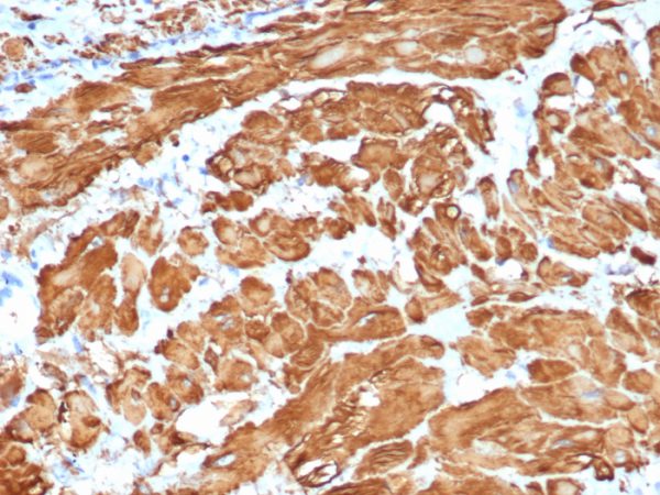 Formalin-fixed, paraffin-embedded human uterus stained with Smooth Muscle Actin Recombinant Rabbit Monoclonal (ACTA2/1614R).
