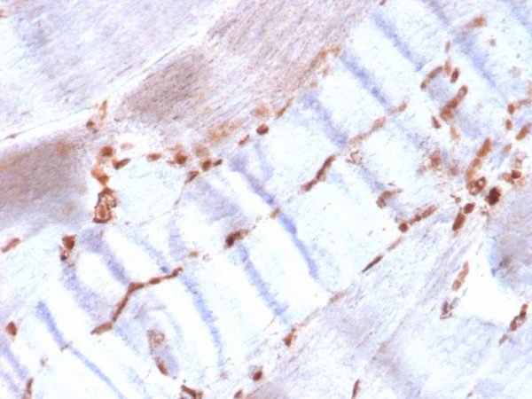 Formalin-fixed, paraffin-embedded human skeletal muscle stained with Smooth Muscle Actin Recombinant Rabbit Monoclonal (ACTA2/1614R).