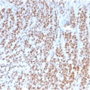 Formalin-fixed, paraffin-embedded human Colon stained with Retinoblastoma (Rb1) Monoclonal Antibody (1F8).
